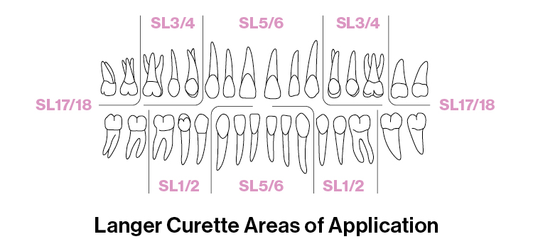 Universal curettes Areas of application